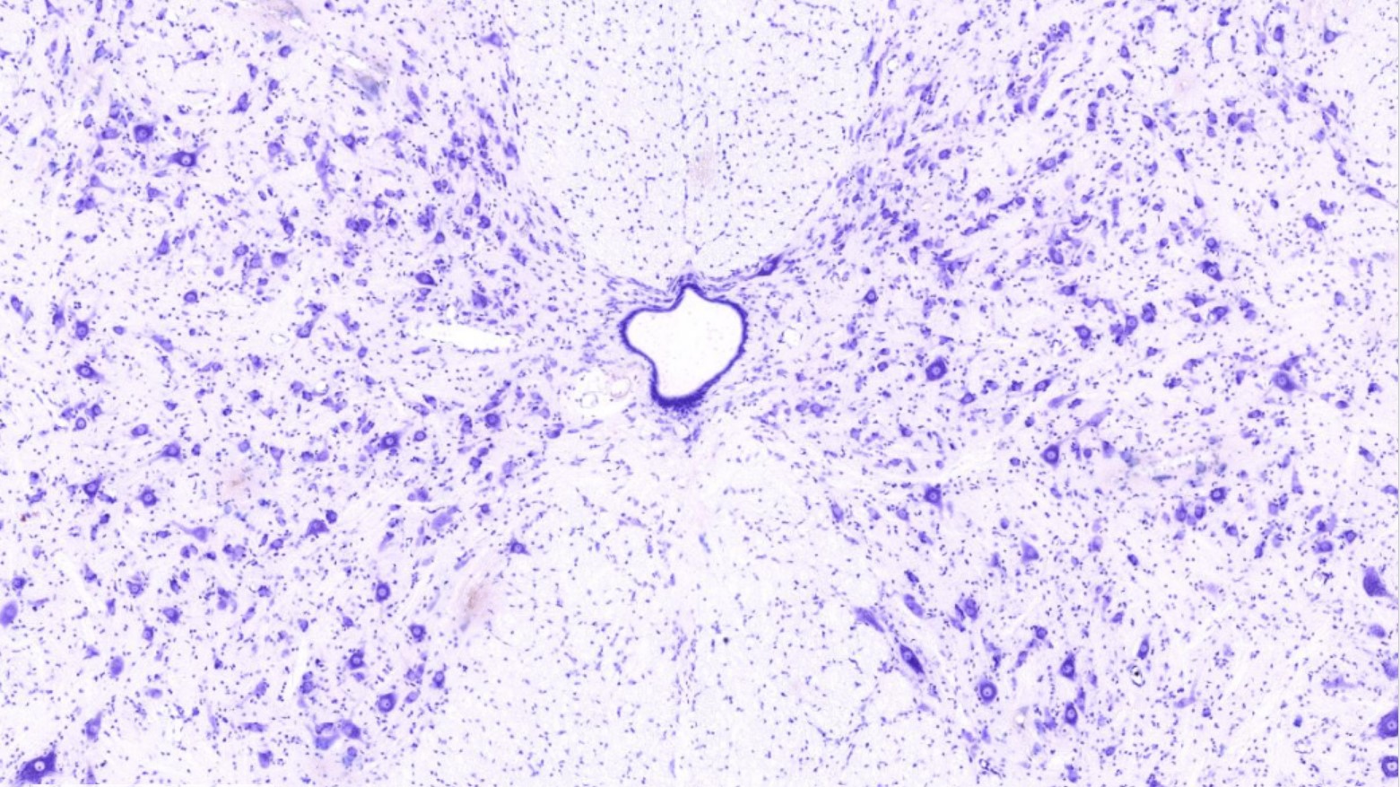 <p>Identifica la plaquita</p>