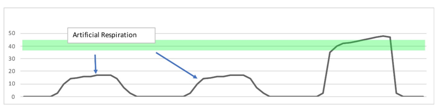 <p>What does this trace show ?</p>