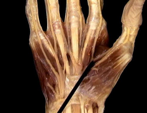 <p>Oppervlakkig, Handpalm</p>