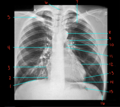 <p>What is labeled 15?</p>