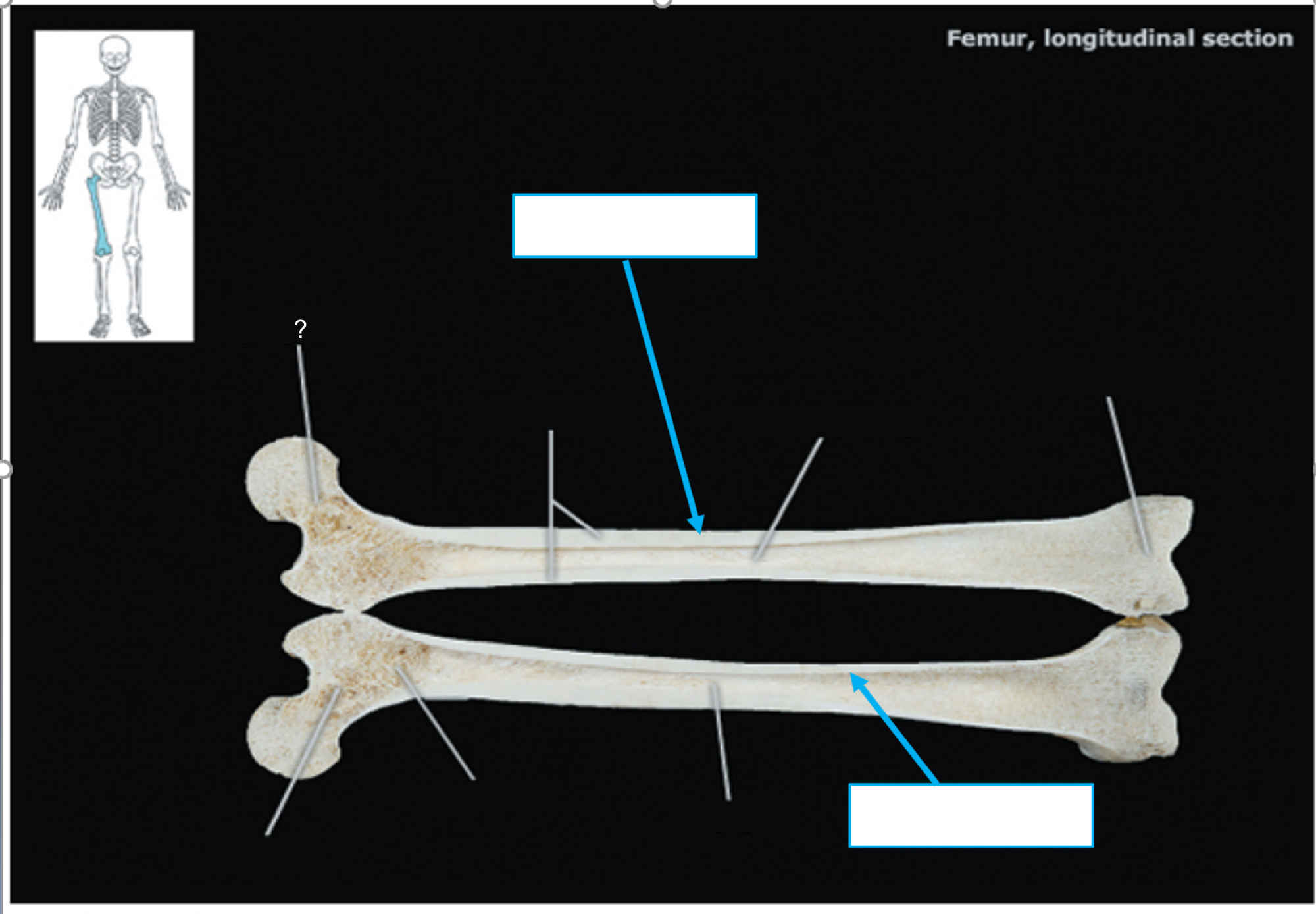 Femur 001: Identify the structure at ?