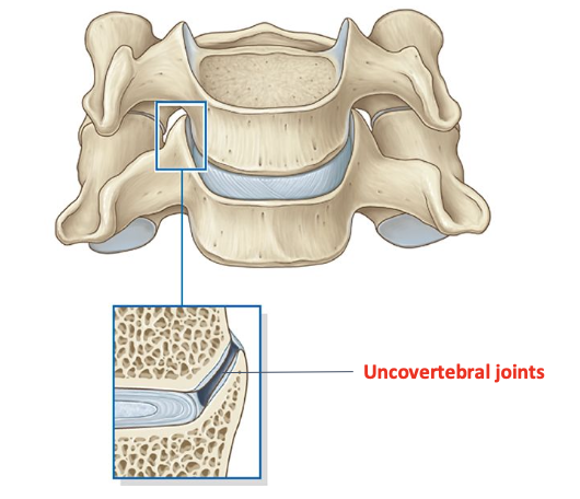 <p>cervical discs - uncovertebral joints</p>