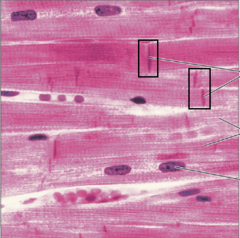 <p>complex junctions that interconnect cardiac muscles cells in the wall of the heart</p>