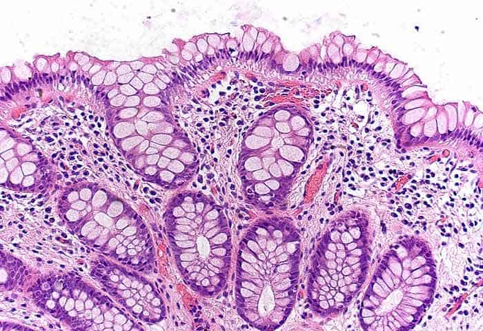 <p>Produces and stores mucus. stains poorly</p>