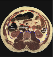 <p>Region posterior to the parietal periotneum (red dashed line) and the posterior abdominal wall is the:</p>