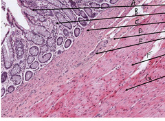 <p>What is indicated by the arrow labeled 'B' in this slide of colon?</p>