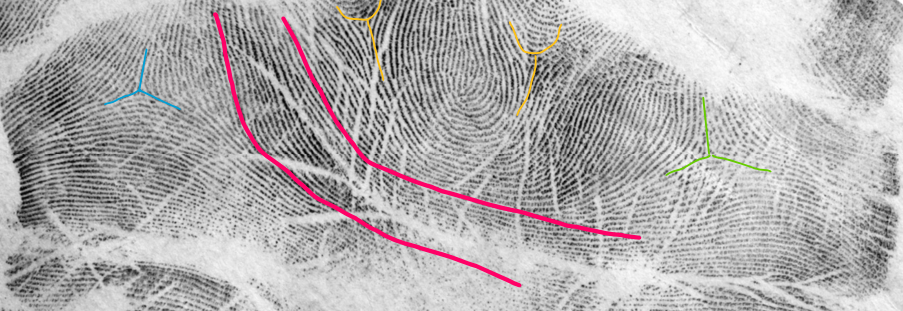 <p>Interdigital</p><ul><li><p><span style="color: rgb(255, 0, 116);">Waterfall ridge flow - right or left</span></p></li><li><p><span style="color: rgb(0, 125, 255);">Clean delta</span></p></li><li><p><span style="color: rgb(255, 192, 3);">Snow cone deltas</span></p></li><li><p><span style="color: rgb(131, 208, 62);">Side cone delta</span></p></li></ul><p></p>