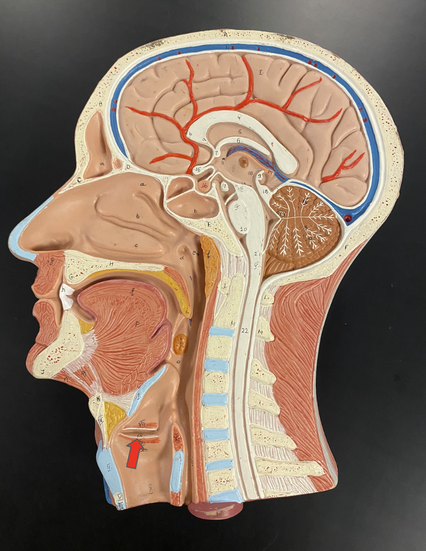 <p>Identify the highlighted structure</p>