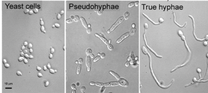 <p>Pseudohyphae is “pinched” ay budding point shorter and more elliptical </p><p>True hyphae is parallel walls, apical elongation, longer & more cylindrical </p>