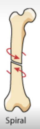 <p>broken from twisting</p>