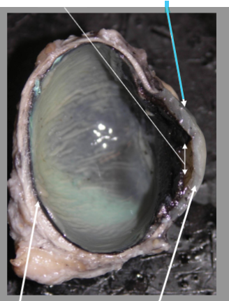 <p>What is the arrow pointing at?</p>