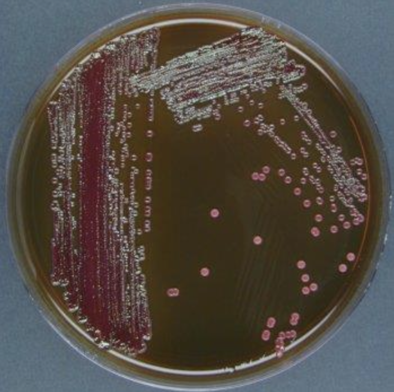 <p>Water Test (results) </p>