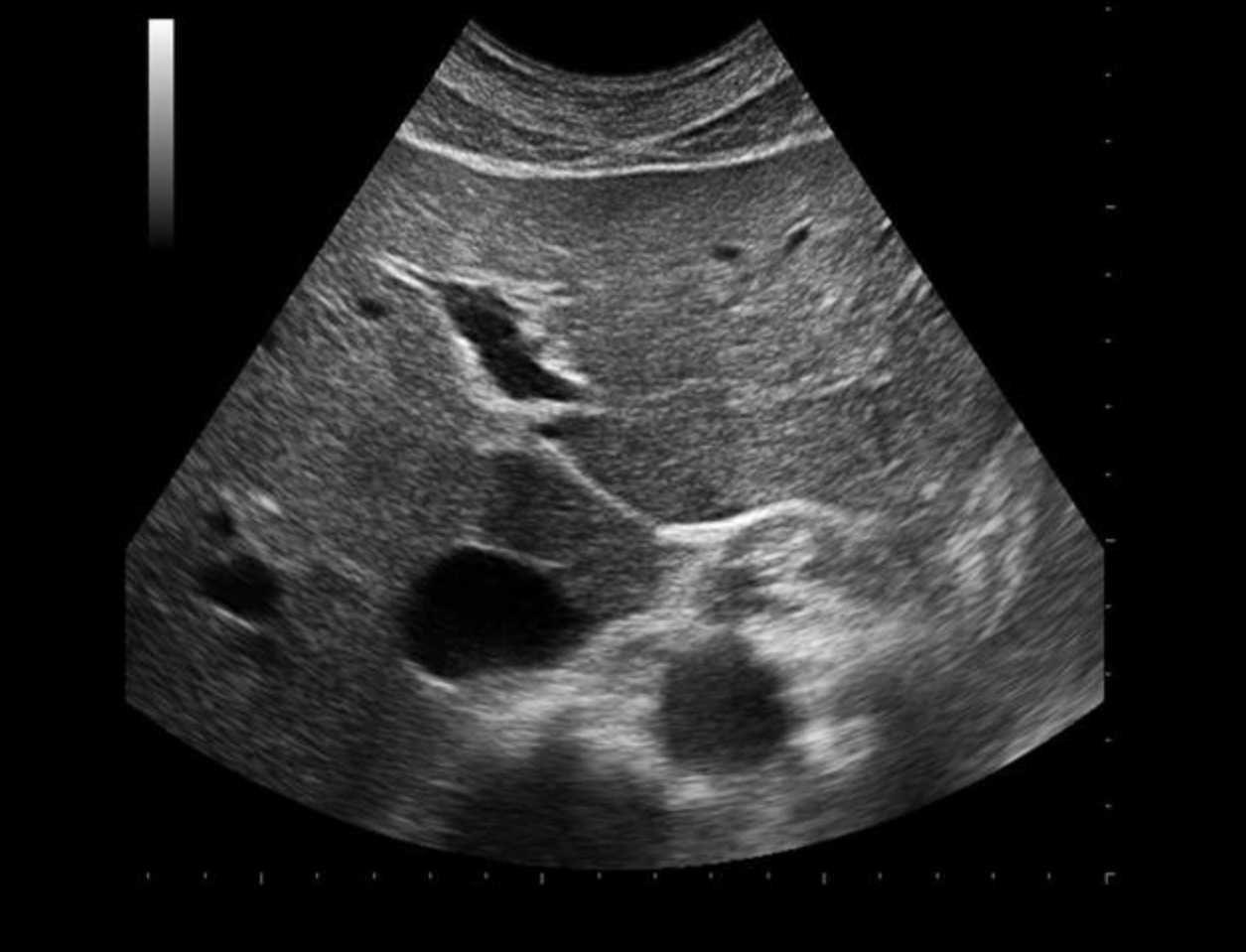 <p>Use your mouse to place your cursor over the ligamentum venosum and click to mark the structure.</p><p></p>