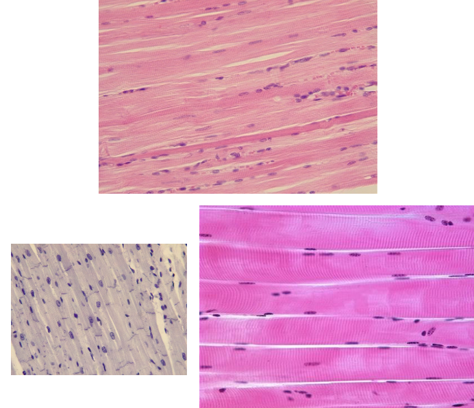 <p>name the stripes seen on the tissues formed by the A and I bands on myofibrils</p>
