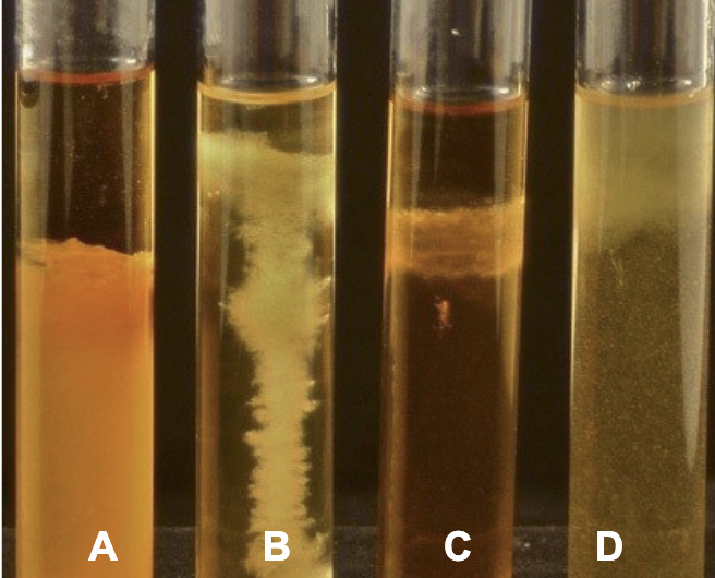 <p>Which tube is <strong>Obligate Aerobe?</strong></p>