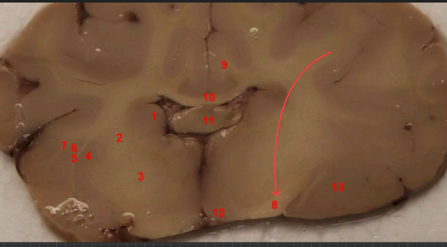 <p>what tract is this </p>