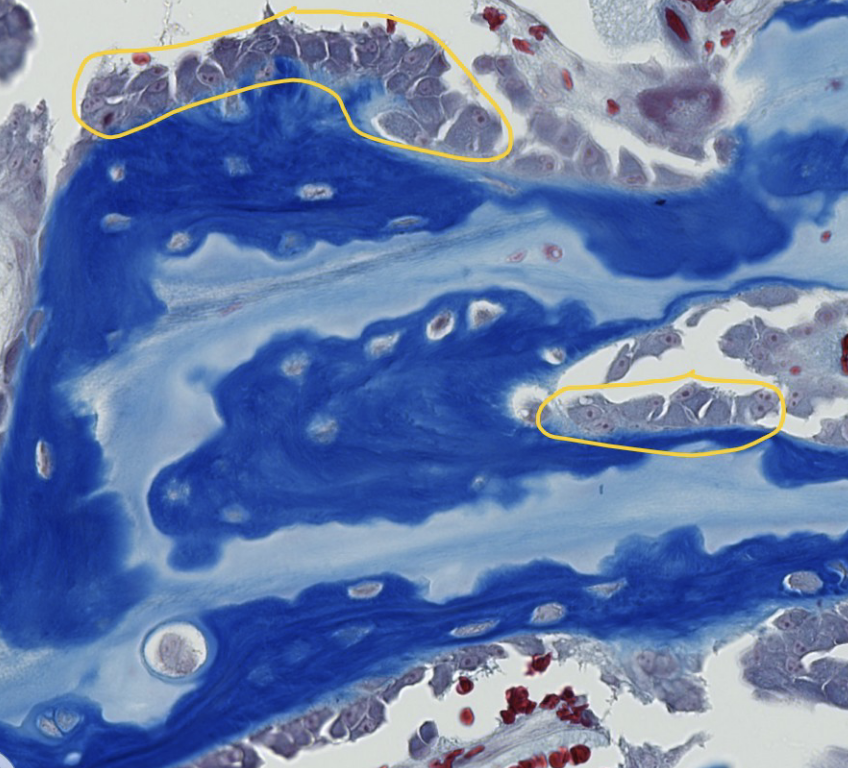 <p>ID the encircled bone cells (hint: they are on he bone surface)</p>