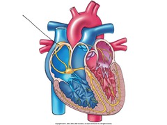 <p>The pacemaker of the heart. This is where the electrical signal arises in normal sinus rhythm (NSR)</p>