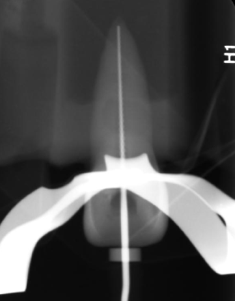 <p>For the working length, if there is difficulty viewing the file, you can use</p>