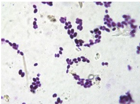 <p>Fungi </p>