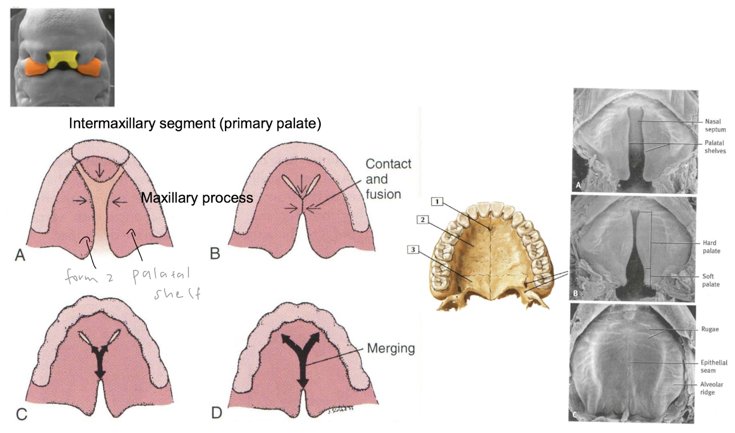 <ul><li><p>comes from fusion between inter maxillary and a pair of maxillary processes </p></li></ul><p></p>