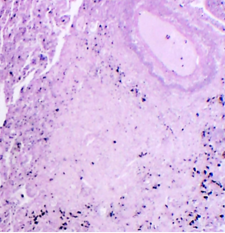 <p>ID this condition, note important features</p>