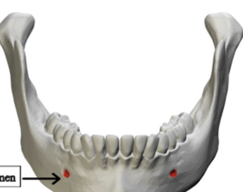 <p>one of two small openings on the front and side of the mandible that allows nerves and blood vessels to reach the chin and lower lip</p>