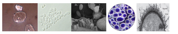 <p><span>Match each micrograph with the microscopy technique used to produce it, from left to right:</span></p>
