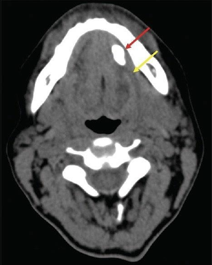 <p>what is this, and what is the yellow arrow pointing at?</p>