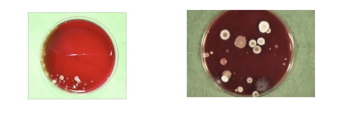<p>Blood Agar Plate</p><p>a) Medium?</p><p>b) Substrate?</p><p>c) Enzyme?</p><p>d) Indicator/Reagent?</p><p>e) End Product?</p>