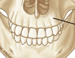 <p>the thickened ridge of bone on the upper and lower jaw that contains the sockets holding the roots of the teeth</p>