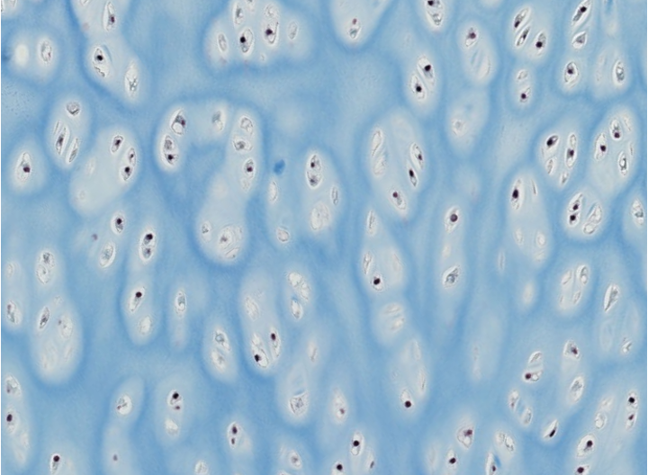 <p><span style="font-family: "Calibri Light";">Which type of CT is this?</span></p>