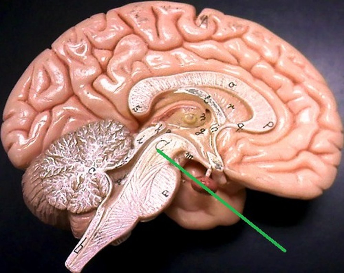<p>cerebral peduncle</p>