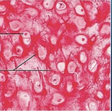 <p>NTK: what type of cartilage is this </p>