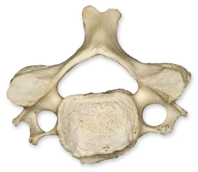 <p>What bone is this?</p>