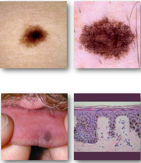 <ul><li><p>occurs without relation to sunlight </p></li></ul><p></p>