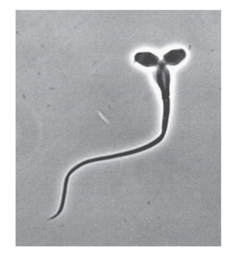 <p>Flesh-feeding flies caused lion populations to crash. This population bottleneck caused inbreeding and increased the frequency of genetic abnormalities like two headed sperm.</p>