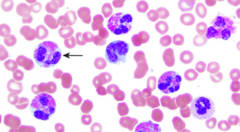 <p>released in allergic reactions, especially in parasitic infections (pink)</p>