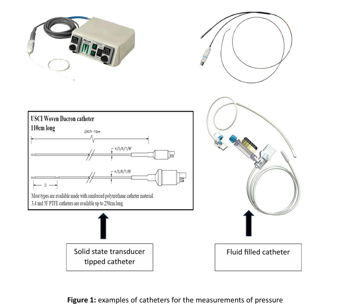 <ul><li><p>time delays for the pressure wave to travel from the measurement site to the transducer is likely and can cause delays</p></li><li><p>noise</p></li></ul><p></p>