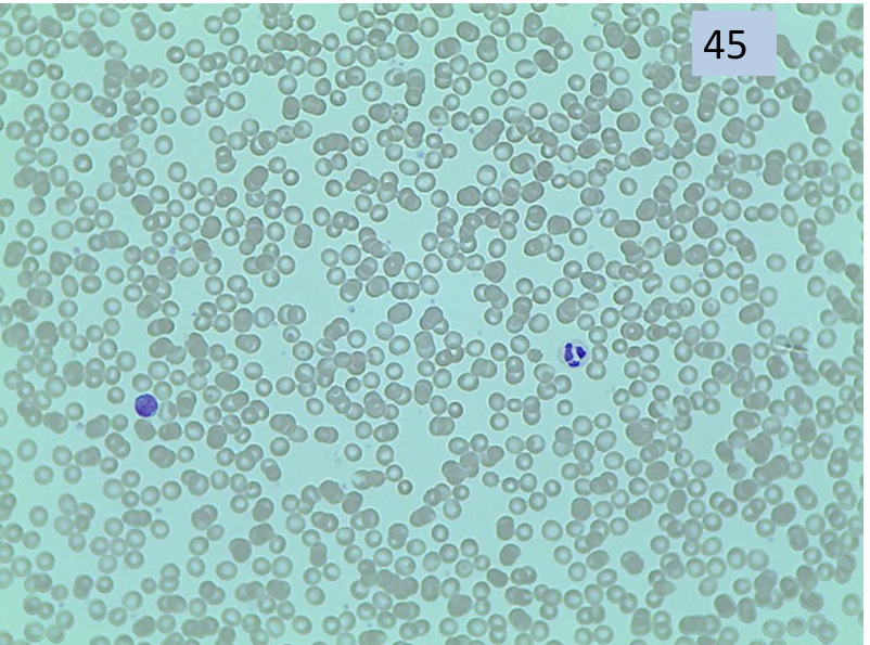 <p>what tissue is this? </p>