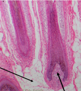 <p>Slide 14 </p>