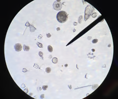 <p>- move via axopodia/pseudopodia; float and feed</p><p>• silica in internal skeleton</p><p>• marine waters</p><p>• unicellular and heterotrophic</p>