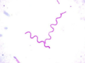 <p>Rigid & Spiral </p>