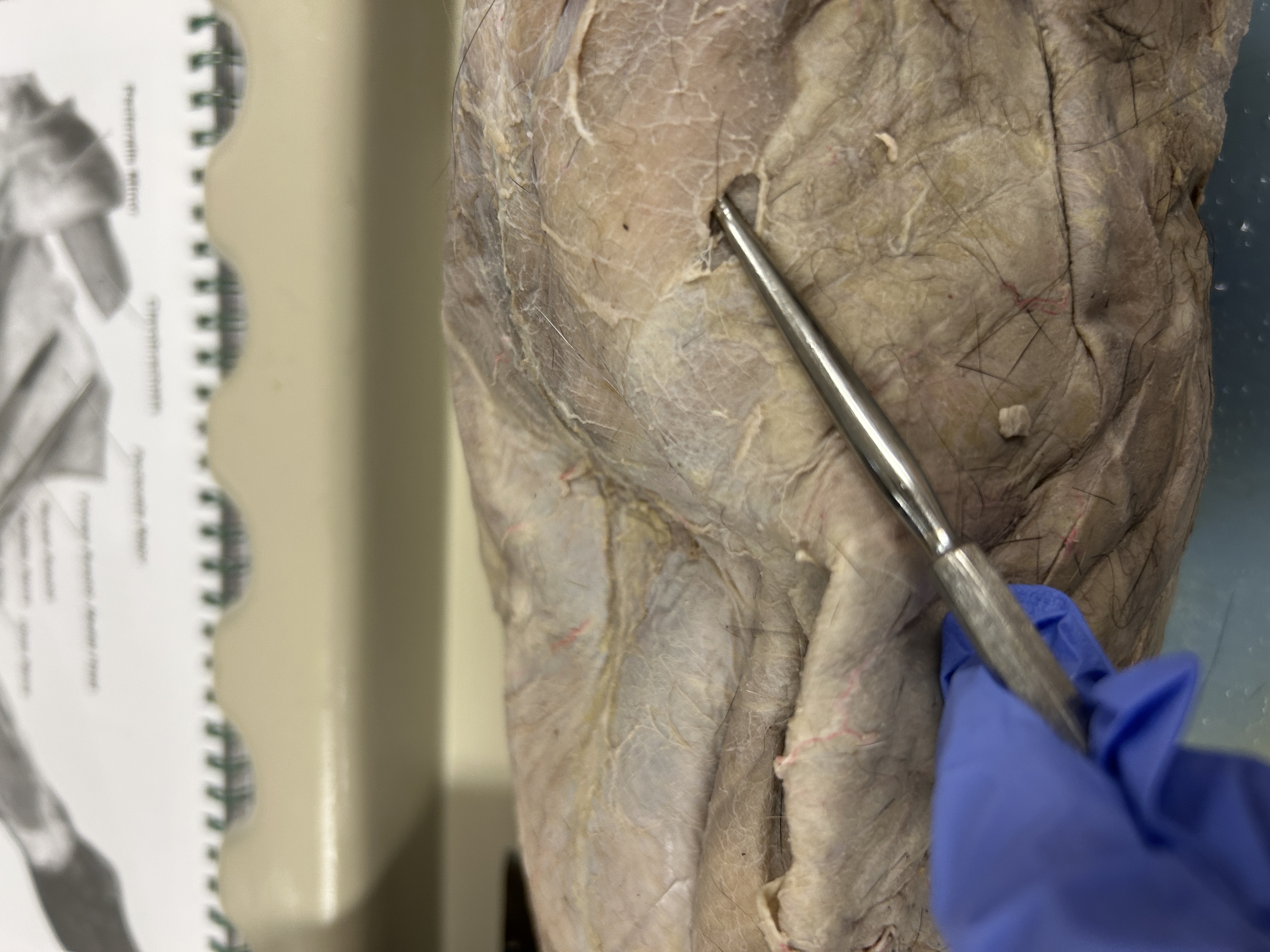 <p>Xiphihumeralis (under pectoralis minor)</p>