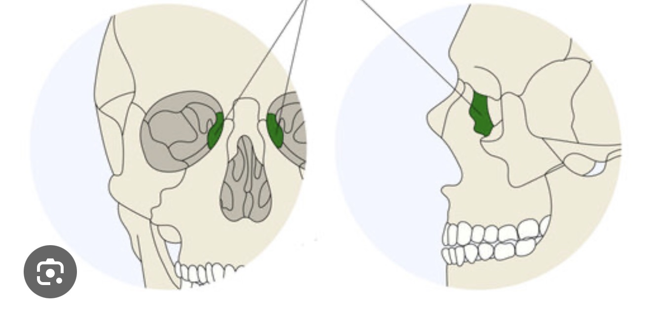 <p>what is this? R/L</p>
