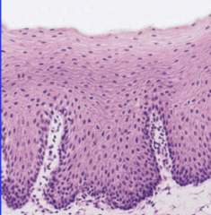<p>- in buccal mucosa, shows no clear distinction between cell strata</p><p>- nuclei are apparent in the surface layers</p><p>- note thickness and epithelial ridge patterns, patterns of maturation</p><p>- no granular layer</p>