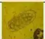 <p>Identify</p>