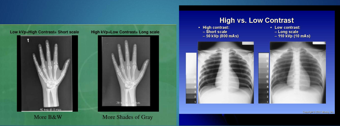<p>difference in densiy of adjacent structures on the image </p><ul><li><p>high contrast & low kVp : more B&W</p><ul><li><p>this is because lower energy photons are more easily absorbed by denser tissue rather than just passing through them</p></li><li><p>creates greater difference in attenuation </p></li></ul></li><li><p>low contrast & high kVp: more greys </p></li></ul><p></p>