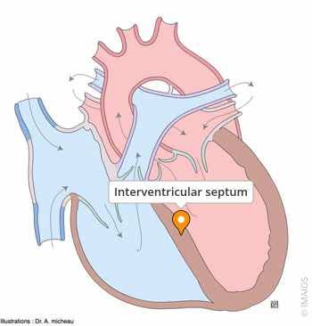 <p>Seperating tissues between ventricles</p>
