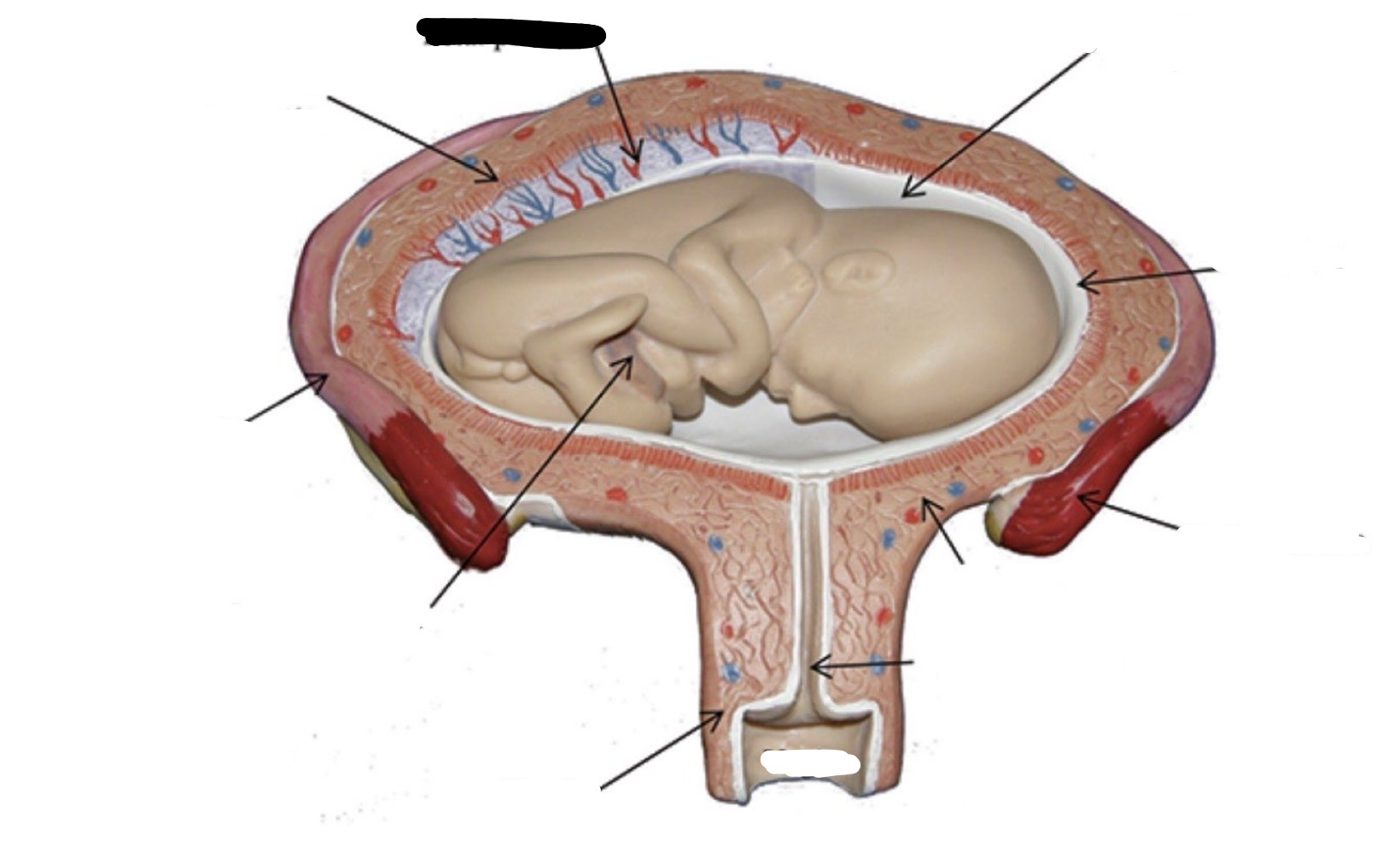 term image